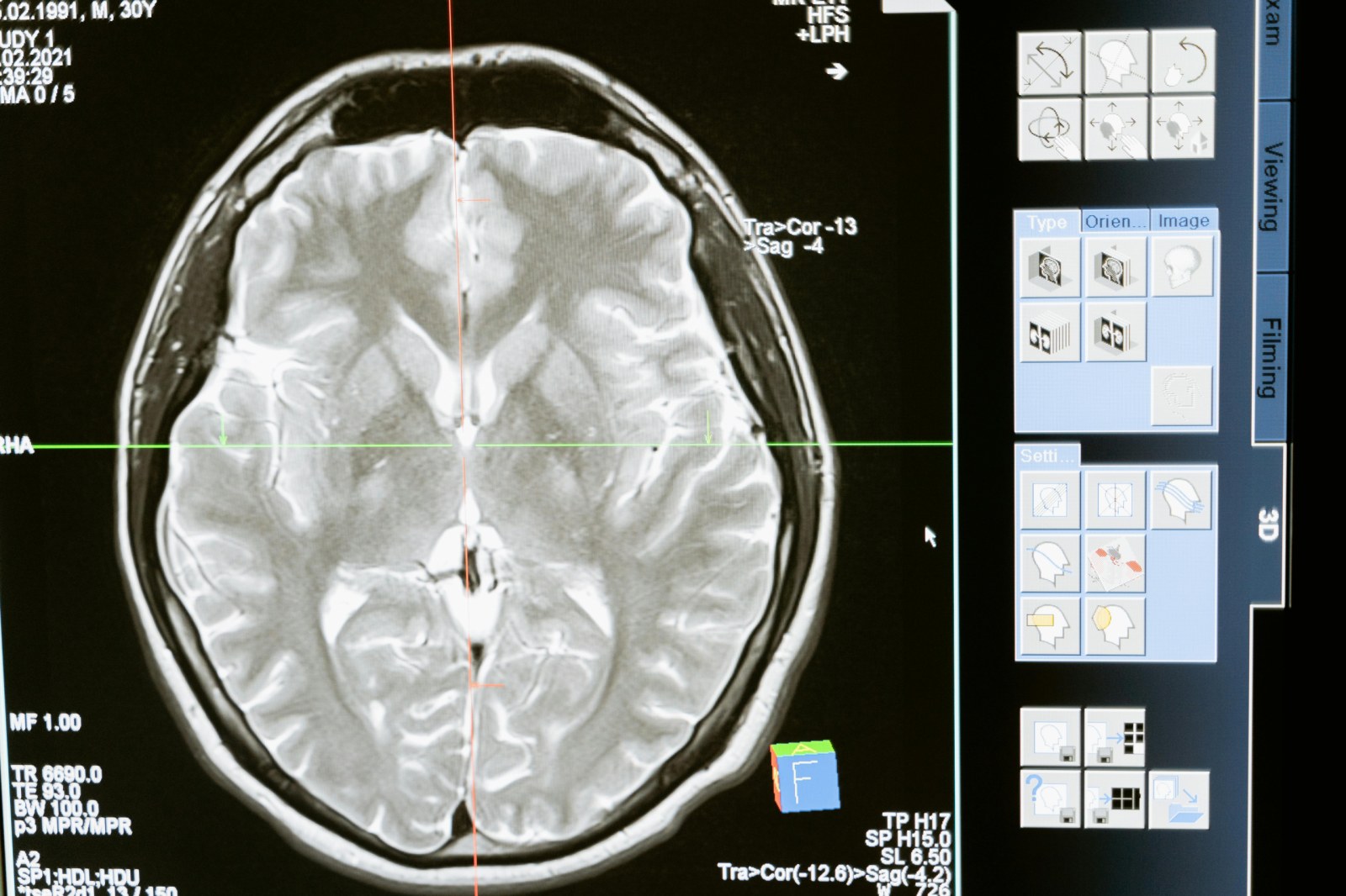 Technology computer head health